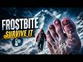 Frostbite Survival Guide ❄️ | Save Yourself Before It’s Too Late!