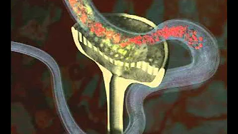 GCSE Science Revision - Homeostasis - How your Kidneys Control Water content in Humans