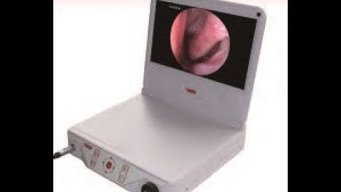 Video about the Medical Endoscope CCD Camera