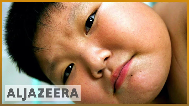 China wealth linked to obesity - DayDayNews