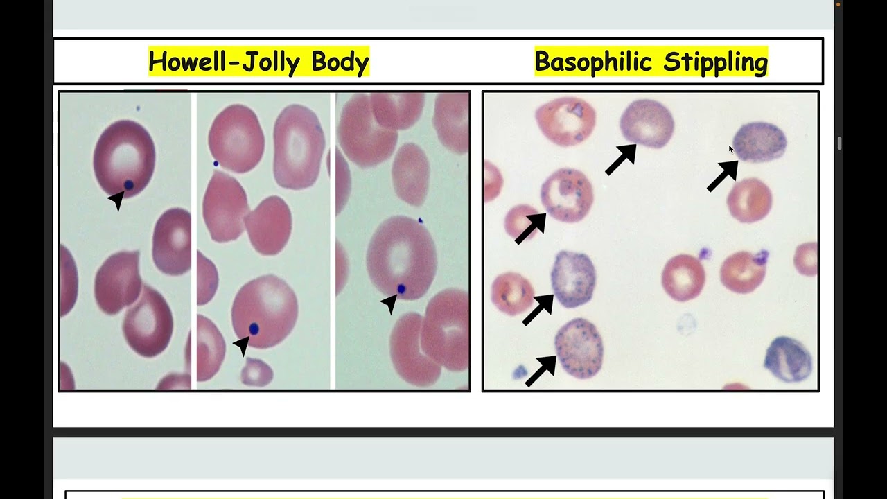 lec 2 blood components (cells and platelets)