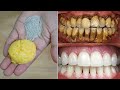 In 3 Minutes Teeth Whitening  -Get Teeth Whitening With Orange Shell Paste With Coffee