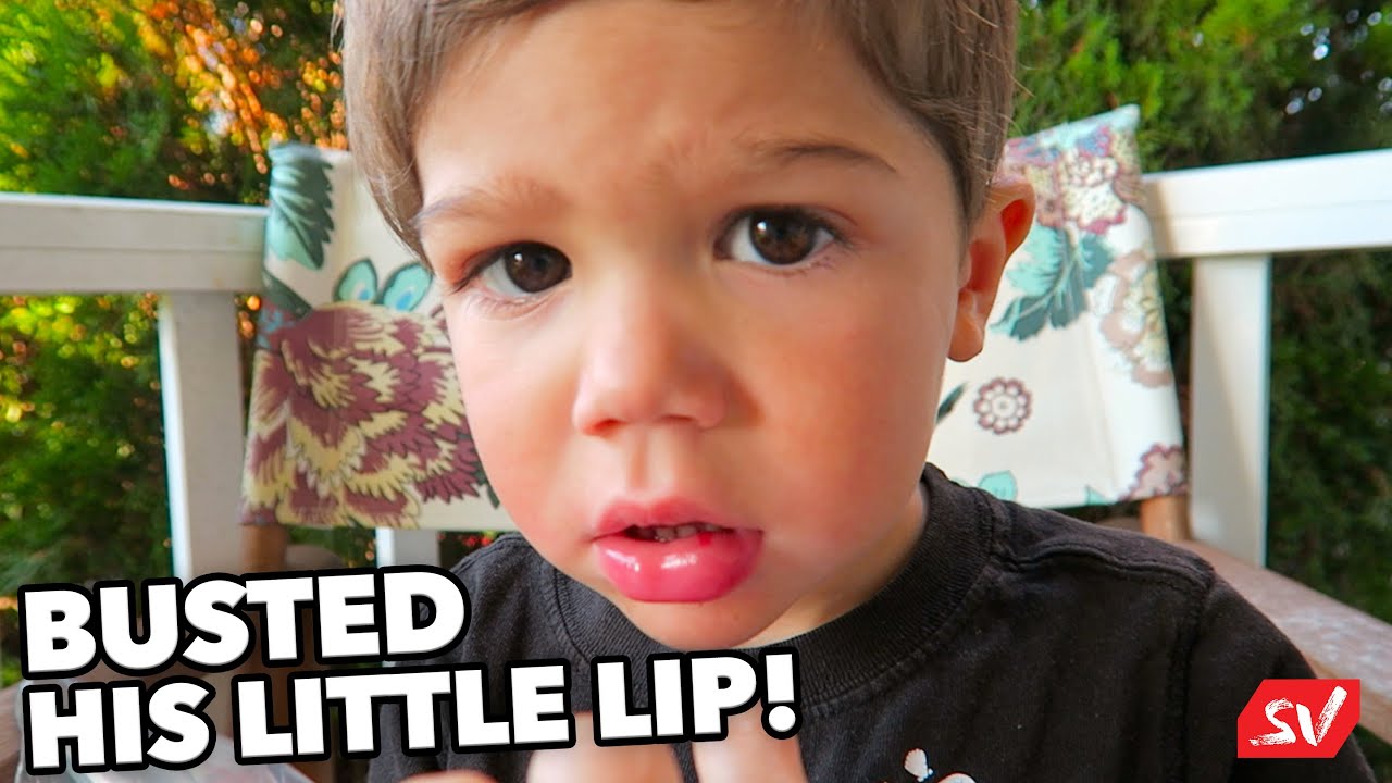 BUSTED HIS LITTLE LIP! 😟 YouTube
