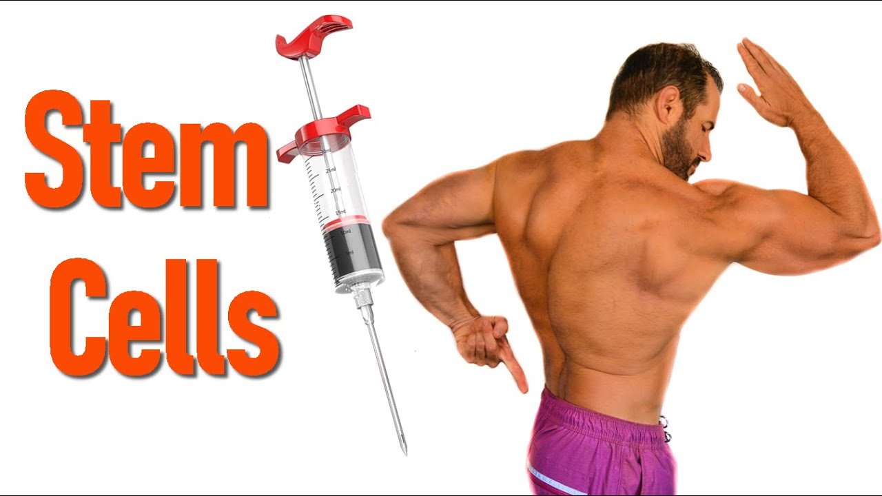 STEM CELL SPINAL MAKEOVER Lumbar Disc Spine Treatment Go IT stem-cell-spinal-makeover-lumbar-disc-spine-treatment-go-it