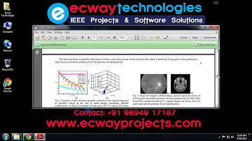 A Watermarking Based Medical Image Integrity Control System and an Image Moment Signature for Tamper