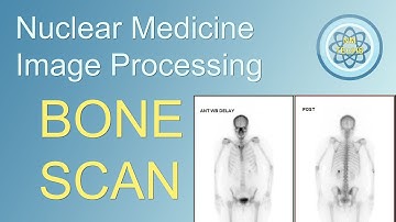 Bone scan imaging processing, in nuclear medicine.