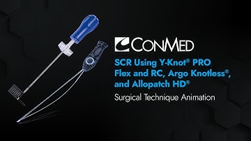SCR Using Y-Knot® PRO Flex and RC, Argo Knotless™, and Allopatch HD® - CONMED Animation