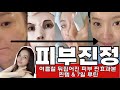 🚨🏖️여름!!😱뒤집어진 피부 효과 본 찐템 &amp;7일 루틴! 트러블, 붉은기, 진정,가려움, 두드러기 효과 봅니다!