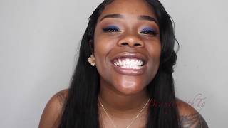 Before & After My Teeth Whitening Experience Smile Brilliant Kit