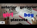 Placental position, baby gender prediction by placental position | my all ultrasounds | Aqsa Mehmood