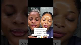 read comments section for full post, music credit not mine YouTube #mbmbskin