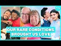 7 beautiful couples living with rare differences  born different