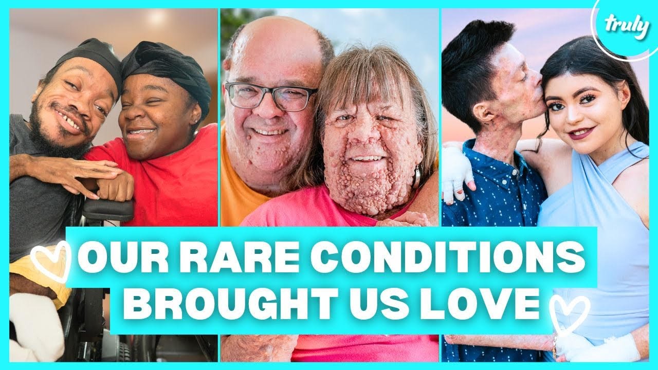 Unique Love Stories: Couples Embracing Rare Differences