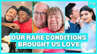 7 Beautiful Couples Living With Rare Differences | Born Different