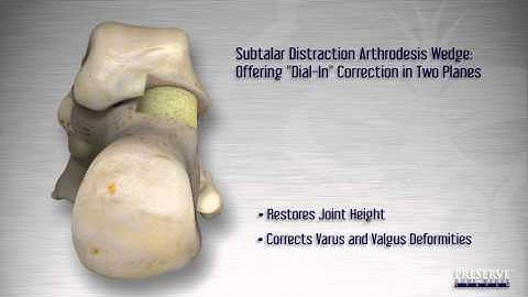 Subtalar Joint Distraction