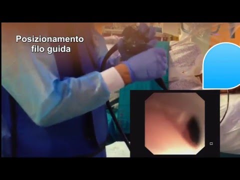 Video: Restringimento Dell'esofago Nei Cani