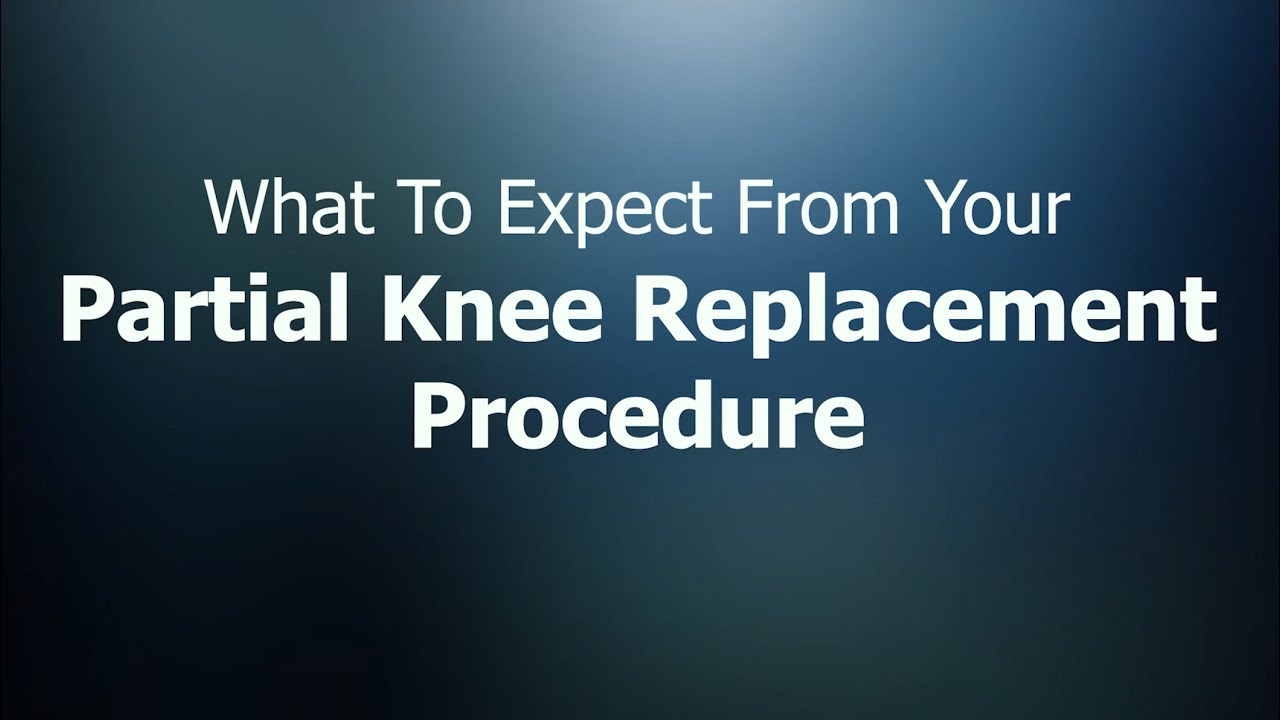 Partial Knee Replacement video thumbnail