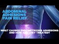 Abdominal adhesions pain relief | What Causes Endometriosis Adhesions and How Are They Treated?