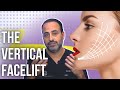 Vertical Facelift Discussion |