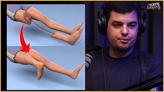 imagem do vídeo Quando se tem TUMOR na perna, essa é a sua SALVAÇÃO | À Deriva Cortes