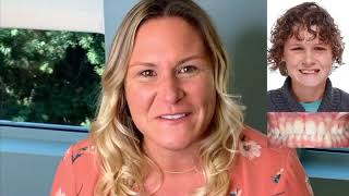 Damon Braces Smile Transformation At Rucker Orthodontics