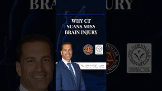 Why CT Scans Miss Brain Injury