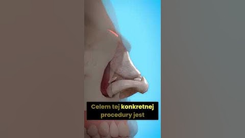 Jak działa operacja nosa 🤔