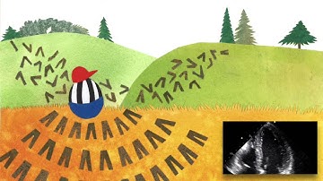 J Electrocardiol Sept/Oct 2015 Cover video