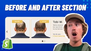 Before and After Section | Shopify No Code Tutorial 2024