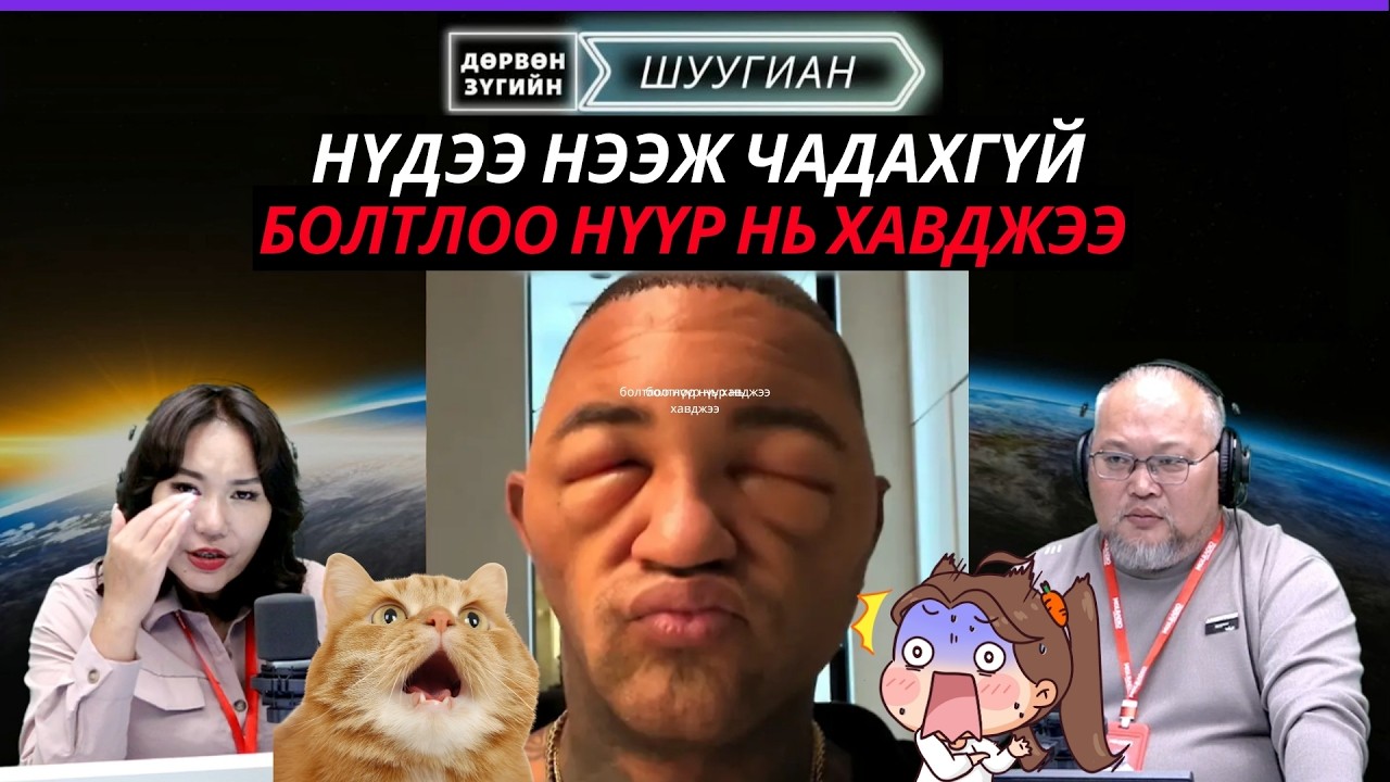Дөрвөн зүгийн шуугиан | 2026-09-10 | Эрүү мултрам үзэсгэлэнтэй хөлбөмбөгчин бүсгүй