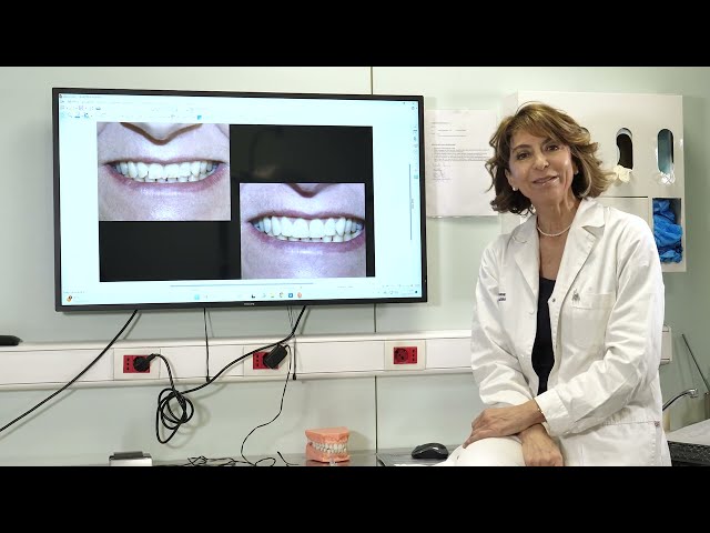 Integrazione tra smalto naturale e smalto sintetico per la della ricostruzione estetica dei denti