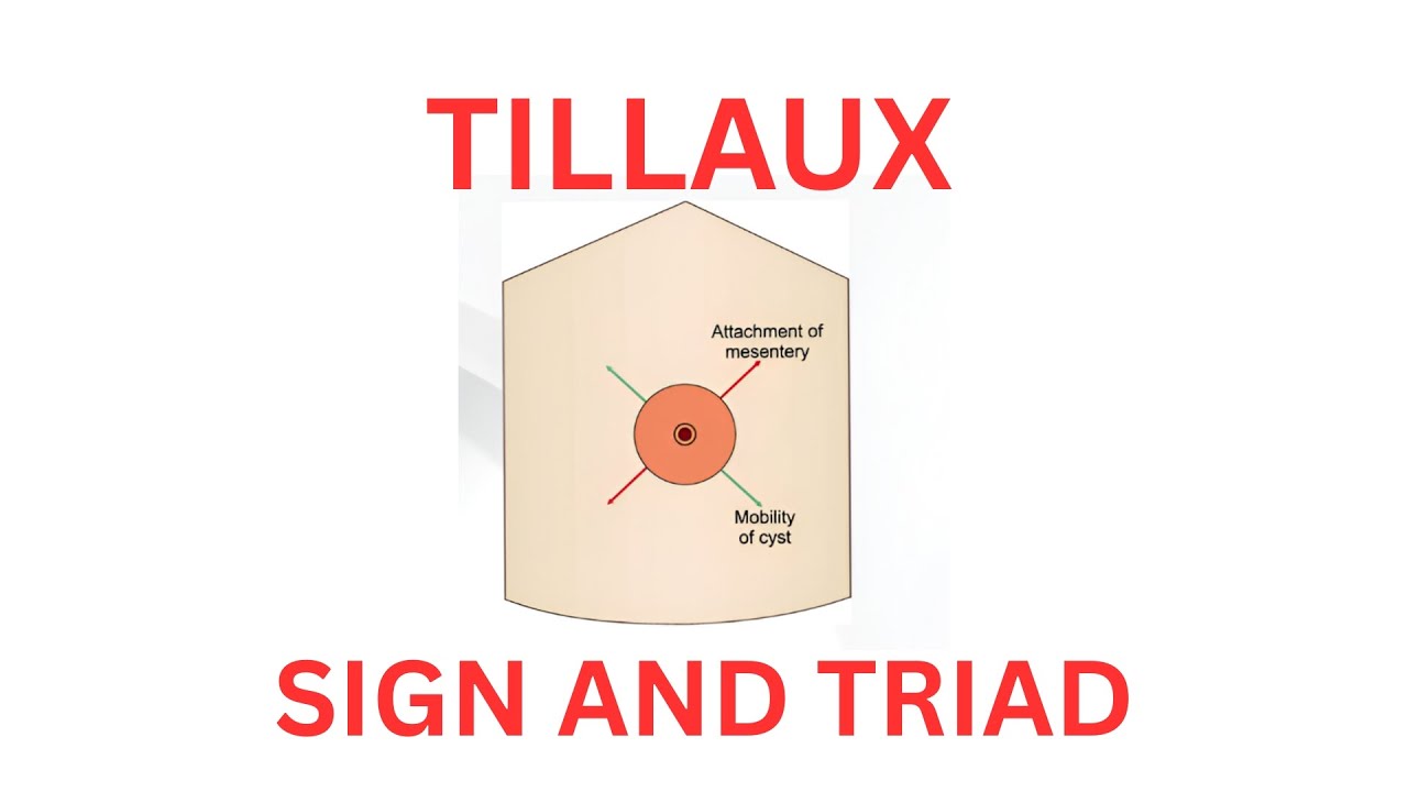 Tillaux sign and triad 