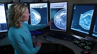 3D Mammography