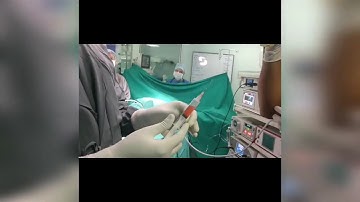 Avoid Surgery with Stem cell BMAC injection for cartilage & sports injuries in athletes