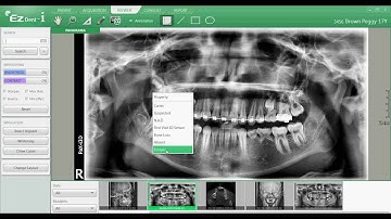 EZDent i, Chapter 03 05   Annotation Tool Bar FINAL