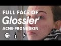 FULL FACE OF GLOSSIER ON ACNE-PRONE SKIN