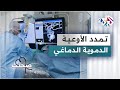 تمدد الأوعية الدموية الدماغي المخاطر وطرق التشخيص وأساليب العلاج mp3
