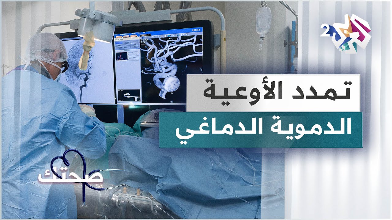 تمدد الأوعية الدموية الدماغي .. المخاطر وطرق التشخيص وأساليب العلاج