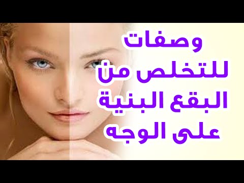 وصفات للتخلص من البقع البنية على الوجه  وصفات للتخلص من البقع البنية على الوجه