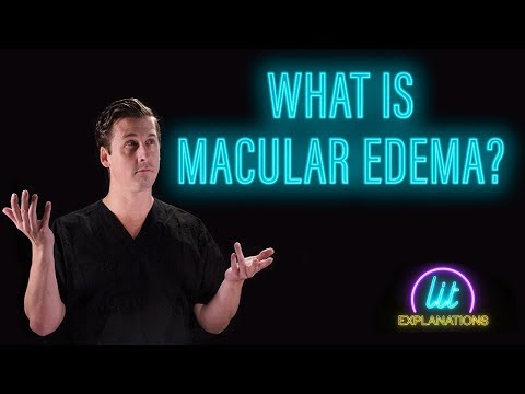 What Is Macular Edema?