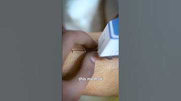 How Medical Staples Work 🤔