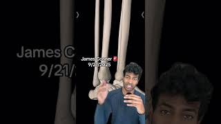 James Conner injury evaluation from a sports doctor #cardinals #fantasyfootball James Conner injury evaluation from a sports doctor #cardinals #fantasyfootball