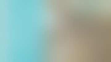 Clinical Video Case Socket Preservation with OSSIX Bone After 2nd Molar Extraction – Zubery