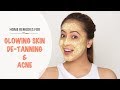 Natural Home Remedies For Glowing Skin, De-Tanning And Acne
