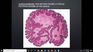 Lecture 26: Soft tissue tumors and tumor-like conditions, Part I. Rook's chapter 137.