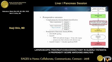 Propensity score matched analysis comparing laparoscopic & open pancreaticoduodenectomy