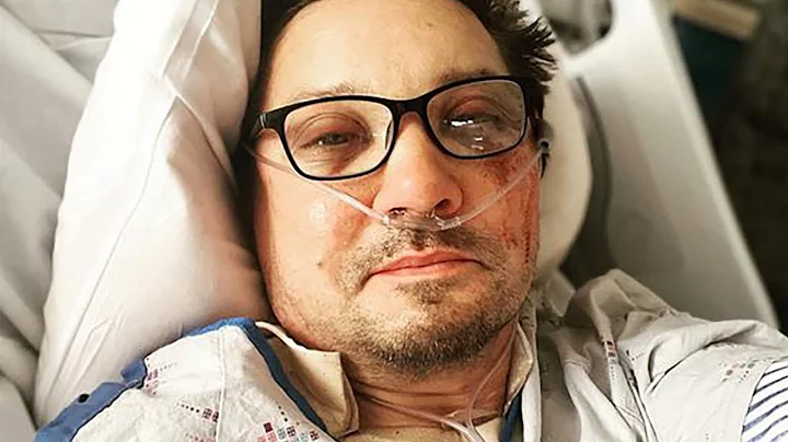 Celebrities Who Were Critically Injured In Accidents