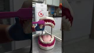 #fb #dentist #trending #stains #transformation #viral #aesthetic #beforeandafter #yt #facts #face