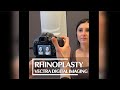 Vectra H2 3D Digital Imaging @AlbertPlasticSurgery