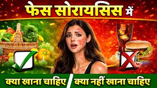 Face Psoriasis Me Kya Khana Chahiye | chehre ke psoriasis kya nahi khana chahiye